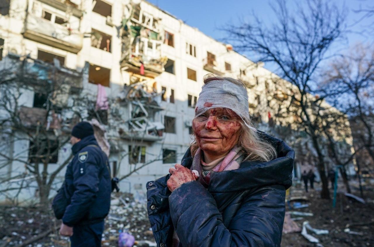 Mujer herida en bombardeo de Chuhuiv el 24 de febrero