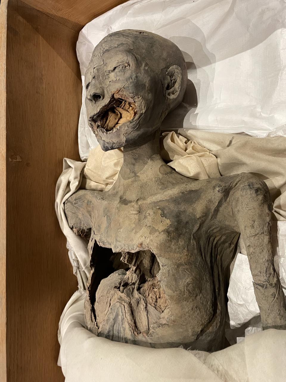 Momia de la momia Tut.  Se cree que murió de un fuerte golpe en la cara.  Su pecho fue colapsado más tarde por ladrones de tumbas.