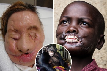 Los ataques más terribles de chimpancés en el mundo, cuando los monos arrancan la cara y los genitales de las personas.