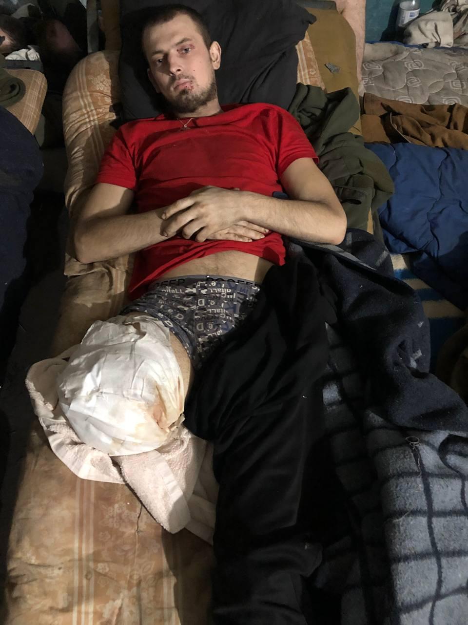 Hombre herido que requiere tratamiento en las instalaciones de Mariupol
