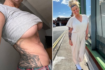 Kerry Katona presume sus nuevos pechos con un profundo mono tras quitarse las vendas