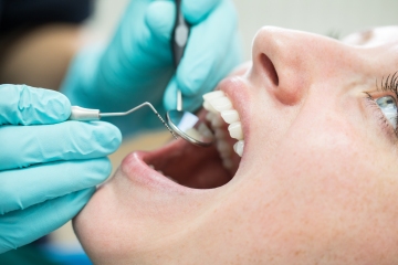 Soy dentista, cosas que sé al mirarte la boca, como si estás embarazada.