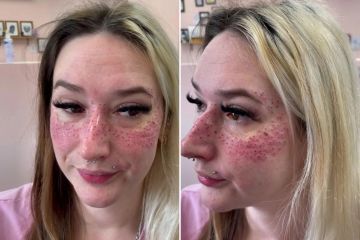Ink pro presume las pecas que le hizo al cliente... pero la gente está aterrada