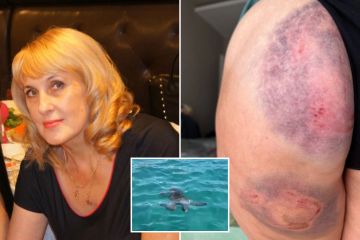 La tortuga marina me atacó y me arrastró bajo el agua - pensé que me iba a morir