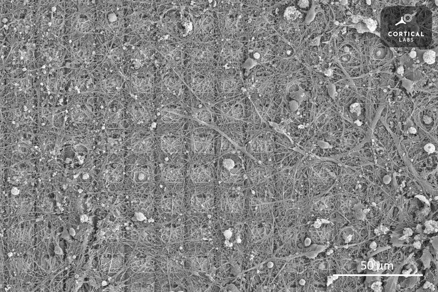 Las células cerebrales que viven en el recipiente pueden aprender a jugar el clásico videojuego Pong.  La foto muestra una imagen de un cultivo de células nerviosas tomada con un microscopio electrónico de barrido.
