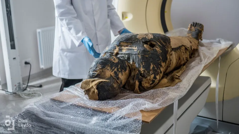 Una antigua momia egipcia descubierta en el siglo XIX también puede tener cáncer
